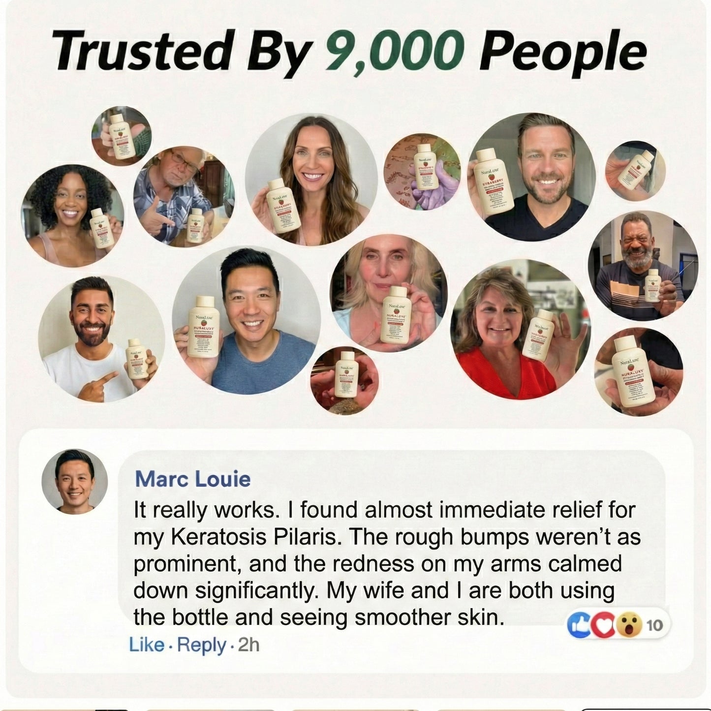 NuraLuxe® Strawberry Skin Resurfacing Cream